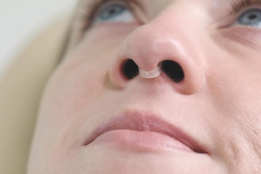 Deviated Septum