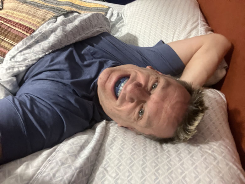 Do Mouthguards Help with Sleep Apnea?