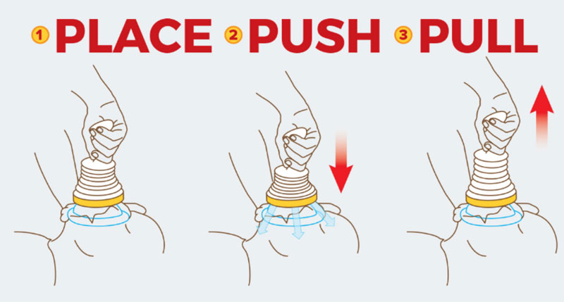lifevac-Place-Push-Pull