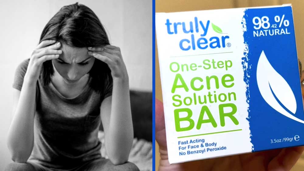 truly-clear-acne-bar--treatment