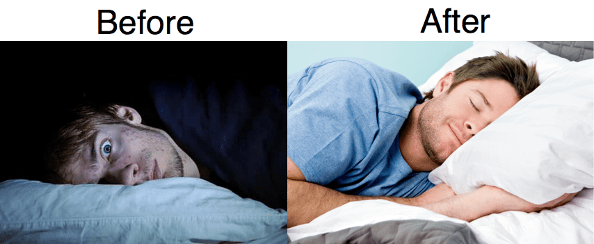 Before-After
